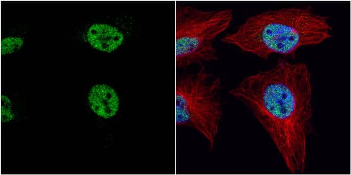 PRDM4 antibody detects PRDM4 protein at nucleus by immunofluorescent analysis.Sample: HeLa cells were fixed in 4% paraformaldehyde at RT for 15 min.Green: PRDM4 protein stained by PRDM4 antibody (NBP2-19926) diluted at 1:1000.Red: alpha Tubulin, a cytoskeleton marker, stained by alpha Tubulin antibody [GT114]  diluted at 1:1000.Blue: Hoechst 33342 staining. 