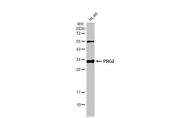 Whole cell extract (30 ug) was separated by 12% SDS-PAGE, and the membrane was blotted with PRG2 antibody (NBP2-19928) diluted at 1:1000. The HRP-conjugated anti-rabbit IgG antibody  was used to detect the primary antibody. 