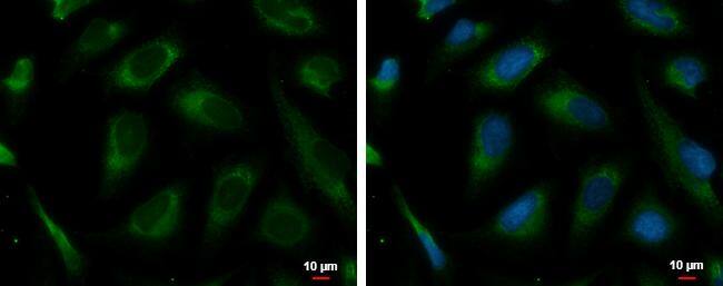 PRKCSH antibody detects PRKCSH protein at endoplasmic reticulum by immunofluorescent analysis.Sample: HeLa cells were fixed in 4% paraformaldehyde at RT for 15 min.Green: PRKCSH protein stained by PRKCSH antibody (NBP2-19931) diluted at 1:500.Blue: Hoechst 33342 staining.Scale bar = 10 um. 