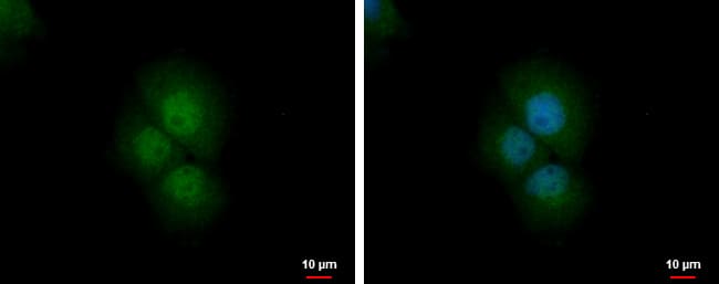 Immunocytochemistry/ Immunofluorescence: PRMT2 Antibody [NBP2-19932] - PRMT2 antibody detects PRMT2 protein at nucleus and cytoplasm by immunofluorescent analysis.Sample: A431 cells were fixed in 4% paraformaldehyde at RT for 15 min.Green: PRMT2 protein stained by PRMT2 antibody (NBP2-19932) diluted at 1:500.Blue: Hoechst 33342 staining.