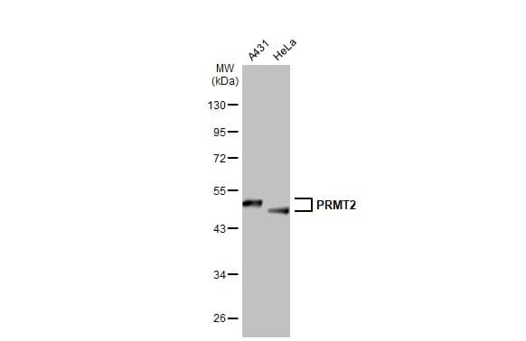 Western Blot: PRMT2 Antibody [NBP2-19932] - Various whole cell extracts (30 ug) were separated by 10% SDS-PAGE, and the membrane was blotted with PRMT2 antibody (NBP2-19932) diluted at 1:3000. The HRP-conjugated anti-rabbit IgG antibody  was used to detect the primary antibody.