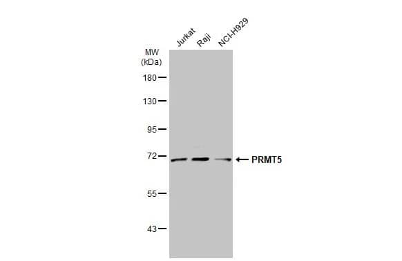 Western Blot: PRMT5 Antibody [NBP2-19935] - Various whole cell extracts (30 ug) were separated by 7.5% SDS-PAGE, and the membrane was blotted with PRMT5 antibody [N1C1] (NBP2-19935) diluted at 1:1000. The HRP-conjugated anti-rabbit IgG antibody  was used to detect the primary antibody.