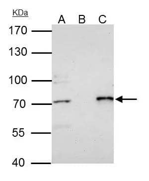 PRMT5 antibody [N1C1] immunoprecipitates PRMT5 protein in IP experiments.IP samples: Raji whole cell extractA. 35 ug Raji whole cell extractB. Control with 4 ug of preimmune Rabbit IgGC. Immunoprecipitation of PRMT5 protein by 4 ug PRMT5 antibody [N1C1] (NBP2-19935)7.5 % SDS-PAGEThe immunoprecipitated PRMT5 protein was detected by PRMT5 antibody [N1C1] (NBP2-19935) diluted at 1:500.[EasyBlot anti-rabbit IgG  was used as a secondary reagent] 