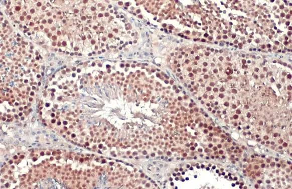 Immunohistochemistry-Paraffin: PRMT5 Antibody [NBP2-19937] - PRMT5 antibody [N3C3] detects PRMT5 protein at cytoplasm and nucleus by immunohistochemical analysis.Sample: Paraffin-embedded mouse testis.PRMT5 stained by PRMT5 antibody [N3C3] (NBP2-19937) diluted at 1:2500.Antigen Retrieval: Citrate buffer, pH 6.0, 15 min