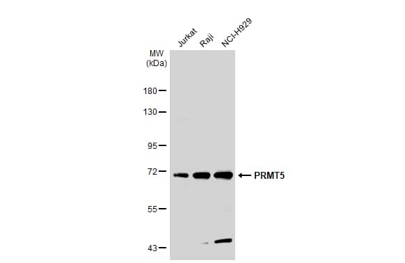 Western Blot: PRMT5 Antibody [NBP2-19937] - Various whole cell extracts (30 ug) were separated by 7.5% SDS-PAGE, and the membrane was blotted with PRMT5 antibody [N3C3] (NBP2-19937) diluted at 1:1000. The HRP-conjugated anti-rabbit IgG antibody  was used to detect the primary antibody.