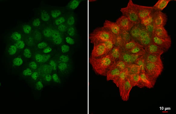 Immunocytochemistry/ Immunofluorescence: PRMT5 Antibody [NBP2-19937] - PRMT5 antibody [N3C3] detects PRMT5 protein at nucleus by immunofluorescent analysis.Sample: A431 cells were fixed in 4% paraformaldehyde at RT for 15 min.Green: PRMT5 stained by PRMT5 antibody [N3C3] (NBP2-19937) diluted at 1:500.Red: alpha Tubulin, a cytoskeleton marker, stained by alpha Tubulin antibody [GT114]  diluted at 1:1000.