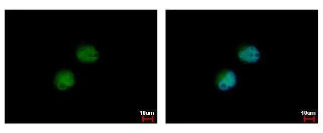 PRMT7 antibody detects PRMT7 protein at cytoplasm and nucleus by immunofluorescent analysis. Sample: HeLa cells were fixed in 4% paraformaldehyde at RT for 15 min.Green: PRMT7 protein stained by PRMT7 antibody (NBP2-19939) diluted at 1:500.Blue: Hoechst 33342 staining. 