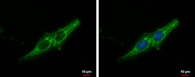 Prohibitin antibody detects Prohibitin protein at mitochondria by immunofluorescent analysis.Sample: SKNSH cells were fixed in 2% paraformaldehyde/culture medium at 37C for 30 min.Green: Prohibitin protein stained by Prohibitin antibody (NBP2-19944) diluted at 1:1000.Blue: Hoechst 33342 staining. 