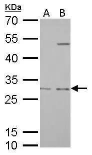 Prohibitin antibody detects PHB protein by Western blot analysis.A. 30 ug PC-12 whole cell lysate/extractB. 30 ug Rat2 whole cell lysate/extract12 % SDS-PAGEProhibitin antibody (NBP2-19944) dilution: 1:1000 