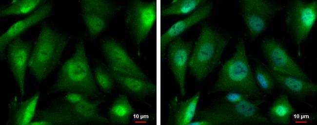 PSMD4 antibody [N1C2] detects PSMD4 protein at cytoplasm and nucleus by immunofluorescent analysis.Sample: SK-N-SH cells were fixed in 4% paraformaldehyde at RT for 15 min.Green: PSMD4 protein stained by PSMD4 antibody [N1C2] (NBP2-19951) diluted at 1:500.Blue: Hoechst 33342 staining. 