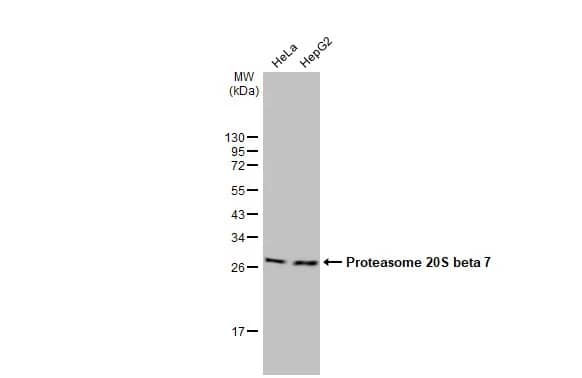 Western Blot: PSMB7 Antibody [NBP2-19954] - Various whole cell extracts (30 ug) were separated by 12% SDS-PAGE, and the membrane was blotted with PSMB7 antibody [N2C3] (NBP2-19954) diluted at 1:1000. The HRP-conjugated anti-rabbit IgG antibody  was used to detect the primary antibody.