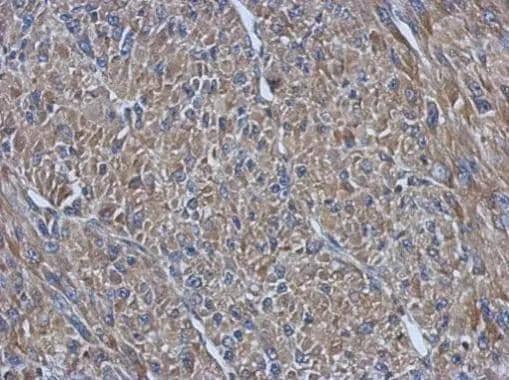 Immunohistochemical analysis of paraffin-embedded U87 xenograft, using PRPSAP2(NBP2-19966) antibody at 1:500 dilution. br>Antigen Retrieval: Trilogy(TM) (EDTA based, pH 8.0) buffer, 15min 