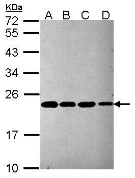 Sample (30 ug of whole cell lysate)  A: A431  B: H1299  12% SDS PAGE  NBP2-19983 diluted at 1:1000  