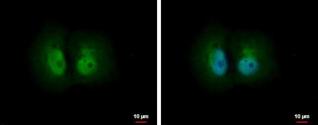 PSME1 antibody detects PSME1 protein at cytoplasm and nucleus by immunofluorescent analysis.Sample: H1299 cells were fixed in 4% paraformaldehyde at RT for 15 min.Green: PSME1 protein stained by PSME1 antibody (NBP2-19991) diluted at 1:500.Blue: Hoechst 33342 staining.Scale bar = 10 um. 