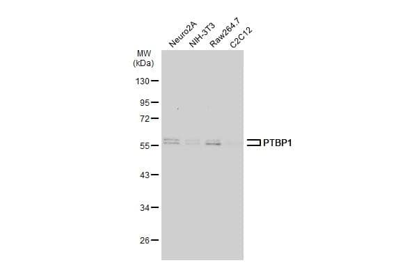 Various whole cell extracts (30 ug) were separated by 10% SDS-PAGE, and the membrane was blotted with PTBP1 antibody (NBP2-19996) diluted at 1:1000. The HRP-conjugated anti-rabbit IgG antibody  was used to detect the primary antibody. 
