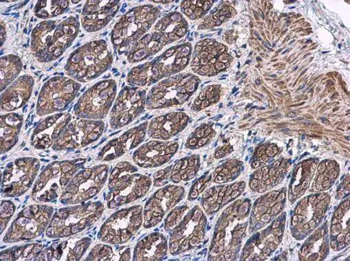 Immunohistochemistry-Paraffin PTPRH Antibody - BSA Free