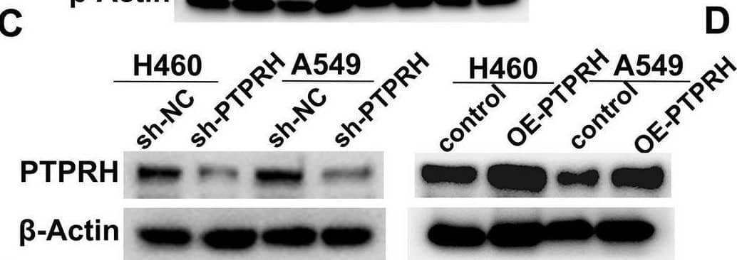 PTPRH promoted proliferation in NSCLC. A, B Detection of PTPRH expression using RT‒PCR and western blotting. C, D Expression of PTPRH after transfection by western blotting analysis and RT‒PCR. E The results of the colony formation assay.) F 3-(4,5-dimethylthiazol-2-yl)-2,5-diphenyltetrazolium bromide (MTT) assay. G, H 5-ethynyl-2′-deoxyuridine (EdU) assay show that PTPRH enhances the proliferation ability of NSCLC cells Image collected and cropped by CiteAb from the following open publication (//pubmed.ncbi.nlm.nih.gov/37974250), licensed under a CC-BY license. Not internally tested by Novus Biologicals.