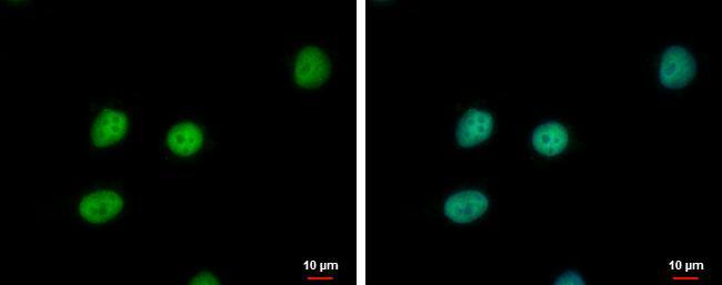 PTTG2 antibody detects PTTG2 protein at nucleus by immunofluorescent analysis.Sample: NT2D1 cells were fixed in 4% paraformaldehyde at RT for 15 min.Green: PTTG2 protein stained by PTTG2 antibody (NBP2-20006) diluted at 1:1000.Blue: Hoechst 33342 staining. 