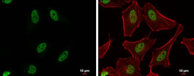 PUF60 antibody detects PUF60 protein at nucleus by immunofluorescent analysis.Sample: HeLa cells were fixed in 4% paraformaldehyde at RT for 15 min.Green: PUF60 protein stained by PUF60 antibody (NBP2-20007) diluted at 1:500.Red: phalloidin, a cytoskeleton marker, diluted at 1:200.Blue: Hoechst 33342 staining.Scale bar = 10 um. 