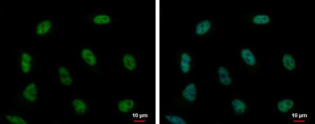 PUF60 antibody detects PUF60 protein at nucleus by immunofluorescent analysis.Sample: A549 cells were fixed in 4% paraformaldehyde at RT for 15 min.Green: PUF60 protein stained by PUF60 antibody (NBP2-20007) diluted at 1:500.Blue: Hoechst 33342 staining. 