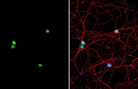 Pumilio 2 antibody [C2C3], C-term detects Pumilio 2 protein by immunofluorescent analysis.Sample: DIV9 rat E18 primary hippocampal neuron cells were fixed in 4% paraformaldehyde at RT for 15 min.Green: Pumilio 2 stained by Pumilio 2 antibody [C2C3], C-term (NBP2-20009) diluted at 1:500.Red: beta Tubulin 3/ Tuj1, stained by beta Tubulin 3/ Tuj1 antibody [GT11710]  diluted at 1:500.Blue: Fluoroshield with DAPI . 