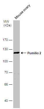 Mouse tissue extract (50 ug) was separated by 7.5% SDS-PAGE, and the membrane was blotted with Pumilio 2 antibody [C2C3], C-term (NBP2-20009) diluted at 1:500. 