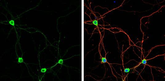 Pumilio 1 antibody [C2C3], C-term detects Pumilio 1 protein by immunofluorescent analysis.Sample: DIV9 rat E18 primary hippocampal neuron cells were fixed in 4% paraformaldehyde at RT for 15 min.Green: Pumilio 1 stained by Pumilio 1 antibody [C2C3], C-term (NBP2-20011) diluted at 1:500.Red: beta Tubulin 3/ Tuj1, stained by beta Tubulin 3/ Tuj1 antibody [GT11710]  diluted at 1:500.Blue: Fluoroshield with DAPI . 