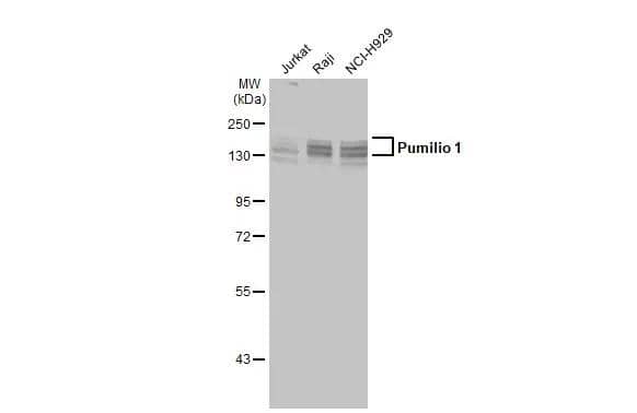 Various whole cell extracts (30 ug) were separated by 7.5% SDS-PAGE, and the membrane was blotted with Pumilio 1 antibody (NBP2-20011) diluted at 1:1000. The HRP-conjugated anti-rabbit IgG antibody  was used to detect the primary antibody, and the signal was developed with Trident ECL plus-Enhanced. 