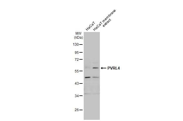 HaCaT whole cell and membrane extracts (30 ug) were separated by 10% SDS-PAGE, and the membrane was blotted with PVRL4 antibody [N1C1] (NBP2-20014) diluted at 1:1000. The HRP-conjugated anti-rabbit IgG antibody  was used to detect the primary antibody. 