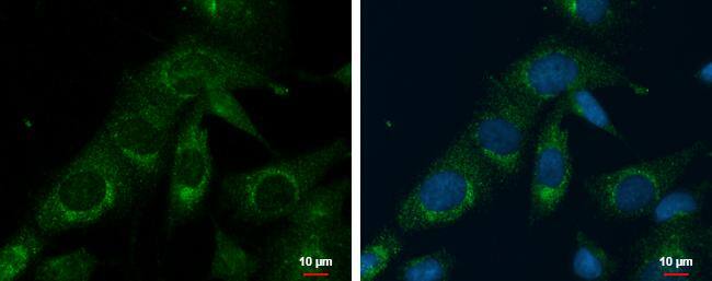 PRELID1 antibody [N1C3-2] detects PRELID1 protein at mitochondria by immunofluorescent analysis.Sample: SKNSH cells were fixed in 2% paraformaldehyde/culture medium at 37oC for 30 min.Green: PRELID1 protein stained by PRELID1 antibody [N1C3-2] (NBP2-20015) diluted at 1:500.Blue: Hoechst 33342 staining.Scale bar = 10 um. 