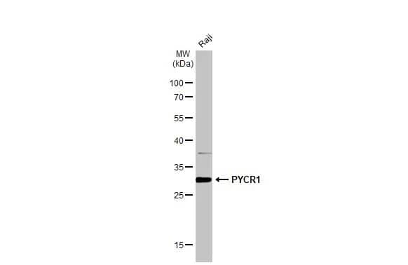 Western Blot: PYCR1 Antibody [NBP2-20016] - Whole cell extract (30 ug) was separated by 12% SDS-PAGE, and the membrane was blotted with PYCR1 antibody (NBP2-20016) diluted at 1:1000. The HRP-conjugated anti-rabbit IgG antibody  was used to detect the primary antibody, and the signal was developed with Trident ECL plus-Enhanced.