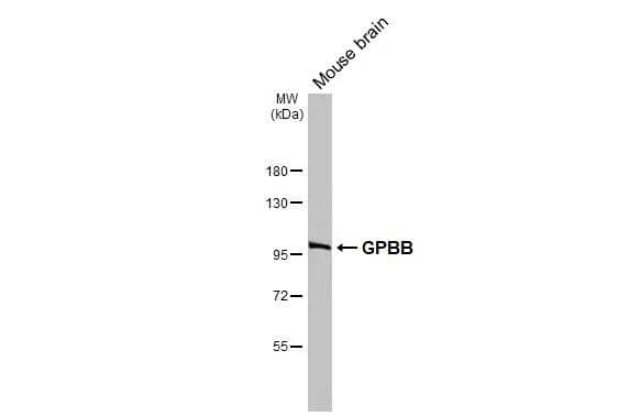 Mouse tissue extract (50 ug) was separated by 7.5% SDS-PAGE, and the membrane was blotted with GPBB antibody [N1N2], N-term (NBP2-20017) diluted at 1:1000. The HRP-conjugated anti-rabbit IgG antibody  was used to detect the primary antibody. 