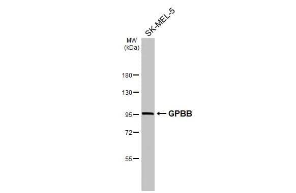 Whole cell extract (30 ug) was separated by 7.5% SDS-PAGE, and the membrane was blotted with GPBB antibody [N1N2], N-term (NBP2-20017) diluted at 1:1000. The HRP-conjugated anti-rabbit IgG antibody  was used to detect the primary antibody. 
