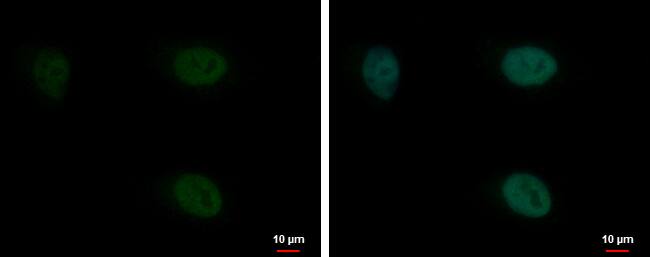 Immunocytochemistry/ Immunofluorescence: Pygopus-2 Antibody [NBP2-20018] - Pygopus-2 antibody detects Pygopus-2 protein at nucleus by immunofluorescent analysis.Sample: HeLa cells were fixed in 4% paraformaldehyde at RT for 15 min.Green: Pygopus-2 protein stained by Pygopus-2 antibody (NBP2-20018) diluted at 1:200.Blue: Hoechst 33342 staining.