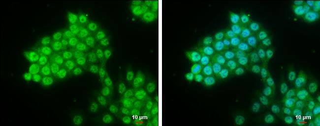 Immunocytochemistry/ Immunofluorescence Pygopus-2 Antibody - BSA Free