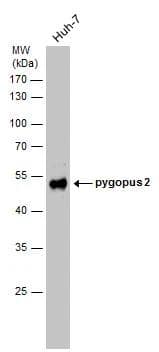 Whole cell extract (30 ug) was separated by 10% SDS-PAGE, and the membrane was blotted with pygopus 2 antibody (NBP2-20020) diluted at 1:1000. 