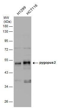 Various whole cell extracts (30 ug) were separated by 10% SDS-PAGE, and the membrane was blotted with pygopus 2 antibody (NBP2-20020) diluted at 1:5000. 