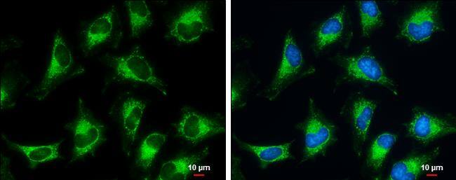 Pyruvate Dehydrogenase E1 beta subunit antibody detects Pyruvate Dehydrogenase E1 beta subunit protein at mitochondria by immunofluorescent analysis.Sample: HeLa cells were fixed in ice-cold MeOH for 5 min.Green: Pyruvate Dehydrogenase E1 beta subunit protein stained by Pyruvate Dehydrogenase E1 beta subunit antibody (NBP2-20024) diluted at 1:500.Blue: Hoechst 33342 staining.Scale bar = 10 um. 