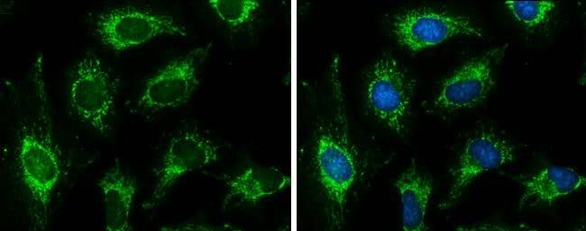 Pyruvate Dehydrogenase E1 beta subunit antibody detects Pyruvate Dehydrogenase E1 beta subunit protein at mitochondria by immunofluorescent analysis.Sample: HeLa cells were fixed in ice-cold MeOH for 5 min.Green: Pyruvate Dehydrogenase E1 beta subunit protein stained by Pyruvate Dehydrogenase E1 beta subunit antibody (NBP2-20025) diluted at 1:500.Blue: Hoechst 33342 staining. 