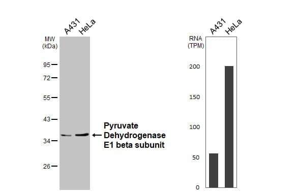 Various whole cell extracts (30 ug) were separated by 10% SDS-PAGE, and the membrane was blotted with Pyruvate Dehydrogenase E1 beta subunit antibody (NBP2-20025) diluted at 1:1000. The HRP-conjugated anti-rabbit IgG antibody  was used to detect the primary antibody. Corresponding RNA expression data for the same cell lines are based on Human Protein Atlas program. 