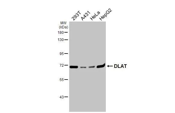 Various whole cell extracts (30 ug) were separated by 7.5% SDS-PAGE, and the membrane was blotted with DLAT antibody (NBP2-20026) diluted at 1:1000. The HRP-conjugated anti-rabbit IgG antibody  was used to detect the primary antibody. 