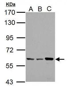 Western Blot PKLR Antibody - BSA Free