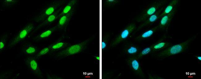 QKI antibody [N2C3] detects QKI protein at cytoplasm and nucleus by immunofluorescent analysis.Sample: SK-N-SH cells were fixed in 4% paraformaldehyde at RT for 15 min.Green: QKI protein stained by QKI antibody [N2C3] (NBP2-20029) diluted at 1:500.Blue: Hoechst 33342 staining.Scale bar = 10 um. 