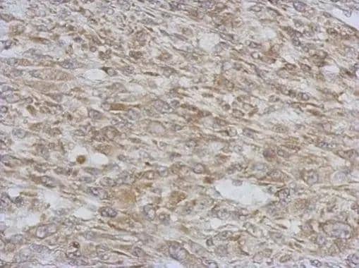 Immunohistochemical analysis of paraffin-embedded C2C12 xenograft, using RAB11-FIP5(NBP2-20035) antibody at 1:500 dilution. br>Antigen Retrieval: Trilogy(TM) (EDTA based, pH 8.0) buffer, 15min 