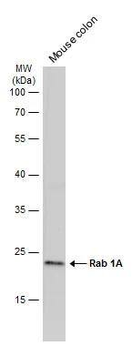 Mouse tissue extract (50 ug) was separated by 12% SDS-PAGE, and the membrane was blotted with Rab 1A antibody [N1C3] (NBP2-20037) diluted at 1:1000. The HRP-conjugated anti-rabbit IgG antibody  was used to detect the primary antibody, and the signal was developed with Trident ECL plus-Enhanced. 