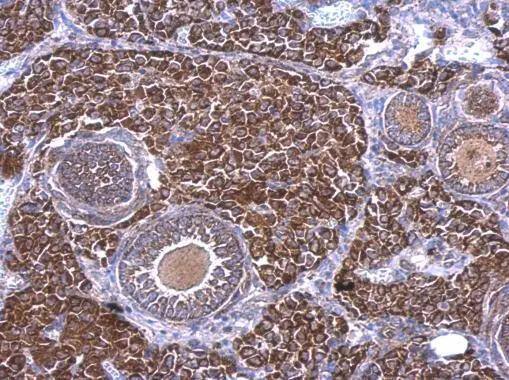 Immunohistochemistry RAB33B Antibody - BSA Free
