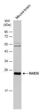 Mouse tissue extract (50 ug) was separated by 12% SDS-PAGE, and the membrane was blotted with RAB35 antibody [N1C3] (NBP2-20042) diluted at 1:1000. The HRP-conjugated anti-rabbit IgG antibody  was used to detect the primary antibody. 