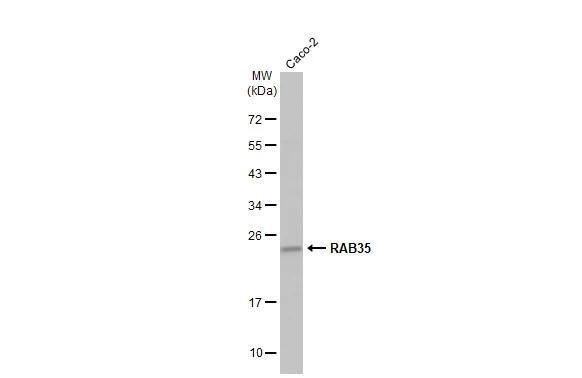 Whole cell extract (30 ug) was separated by 12% SDS-PAGE, and the membrane was blotted with RAB35 antibody [N1C3] (NBP2-20042) diluted at 1:1000. The HRP-conjugated anti-rabbit IgG antibody  was used to detect the primary antibody. 