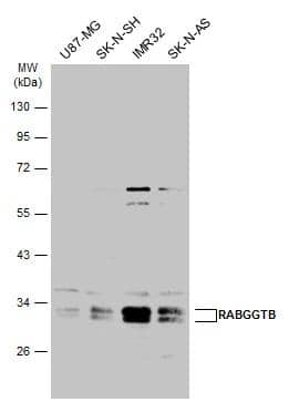 Western Blot RABGGTB Antibody