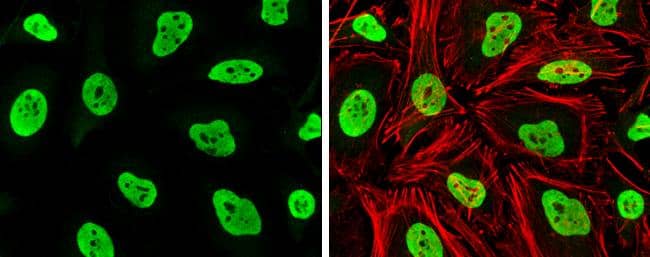 Rad21 antibody detects Rad21 protein at nucleus by immunofluorescent analysis.Sample: HeLa cells were fixed in 4% paraformaldehyde at RT for 15 min.Green: Rad21 stained by Rad21 antibody (NBP2-20053) diluted at 1:1000.Red: phalloidin, a cytoskeleton marker, diluted at 1:100. 